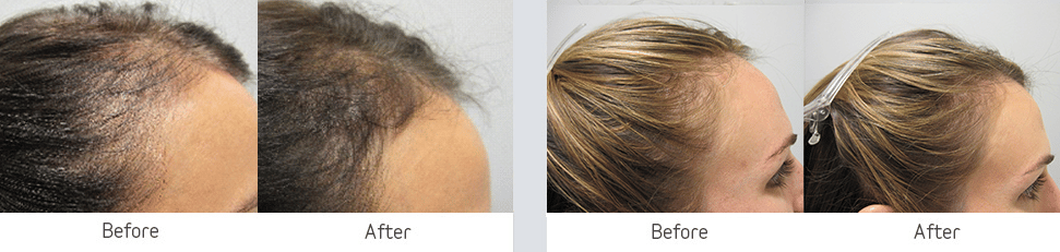 beforeandafter 5 6 1
