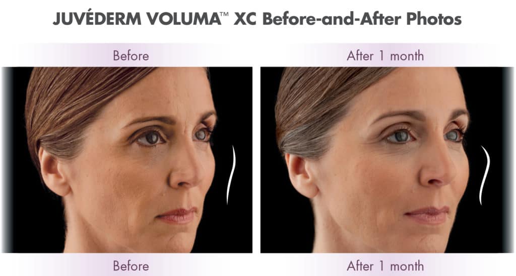 voluma results 1024x549 2