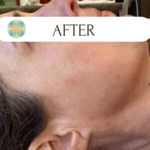 After Image: IPL