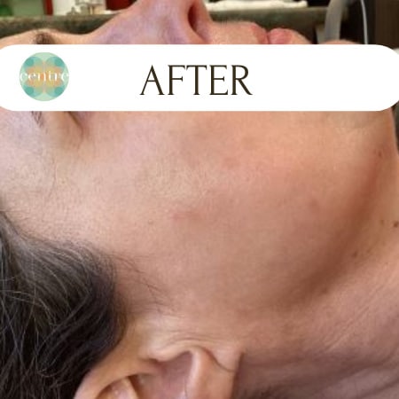 After Image: IPL - front