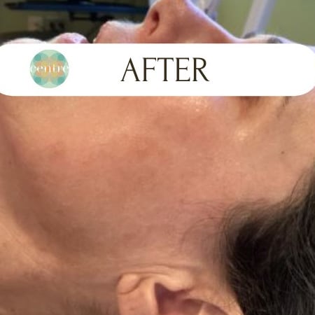 After Image: IPL - front