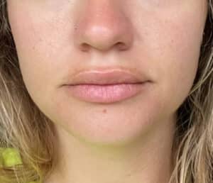 After Image: Lip Flip